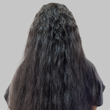 before-and-after-model2-1